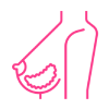 Mastectomy (removal of the breast)