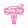 Hysterectomy