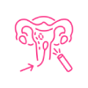 Ovarian Tumour Removal