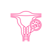 ovarian tissue freezing